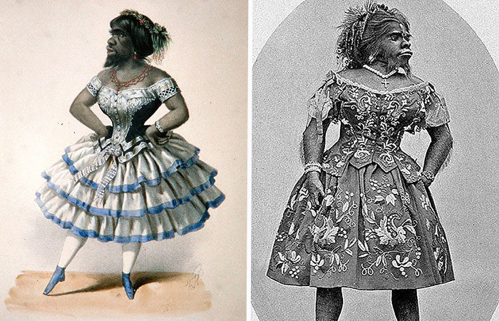 “Maymun Kadın” Gösterileriyle Tanınan Julia Pastrana’nın Hüzünlü Hikayesi